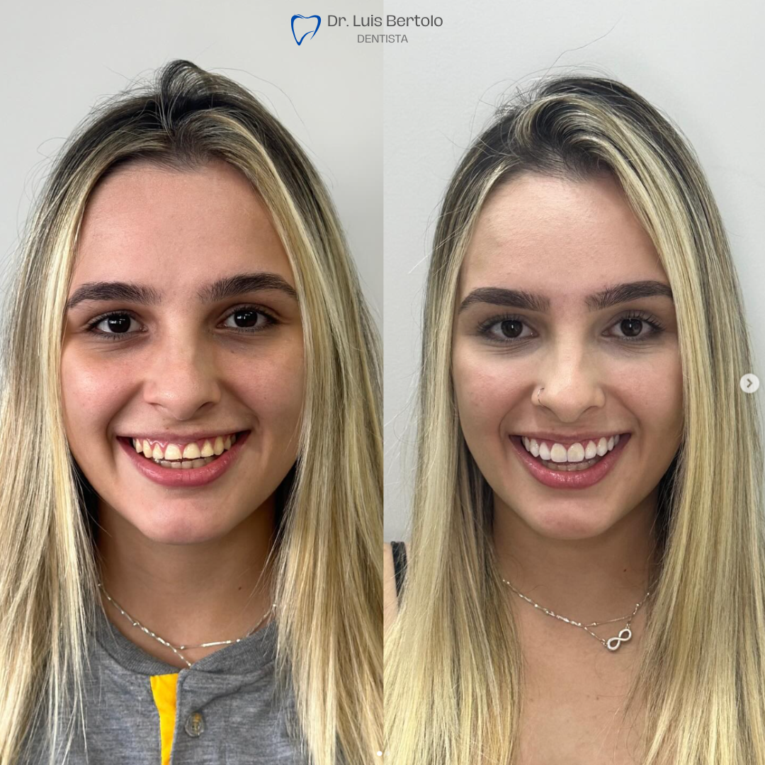 Dr. Luiz Bertolo (11)