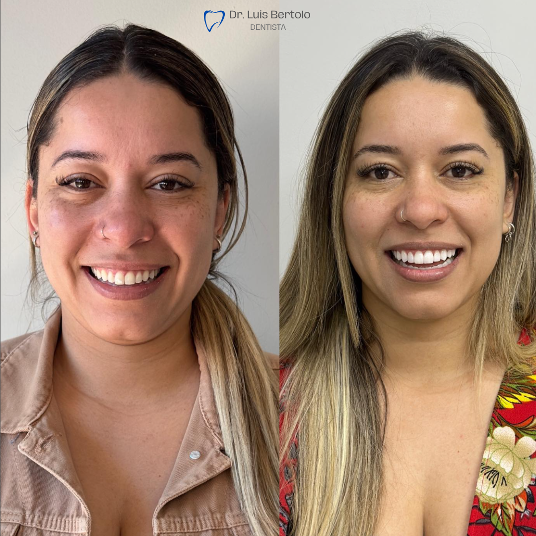 Dr. Luiz Bertolo (16)