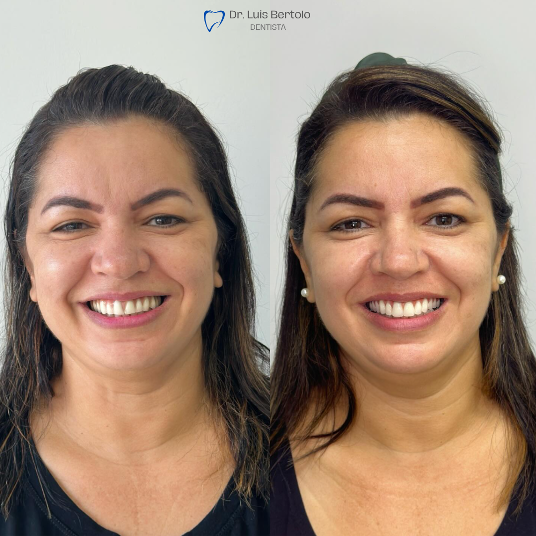 Dr. Luiz Bertolo (9)